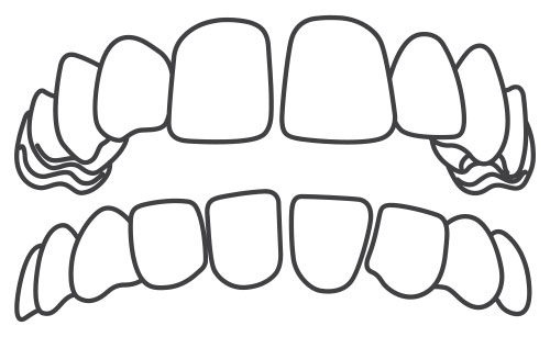 Gap Teeth