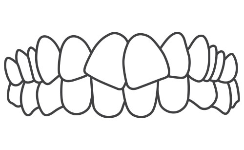Straighter Teeth